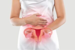 PCOS Explained: What Every Woman Should Know